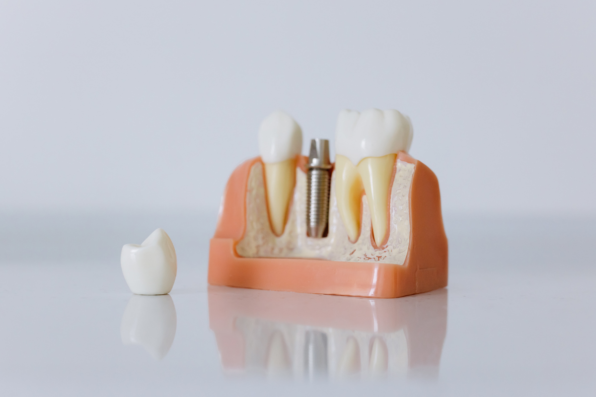 https://khatimdentalcenter.com/wp-content/uploads/2026/06/Design-sans-titre-4.png